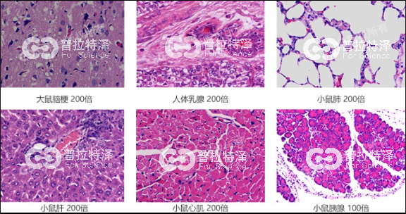 HE染色-普拉特澤
