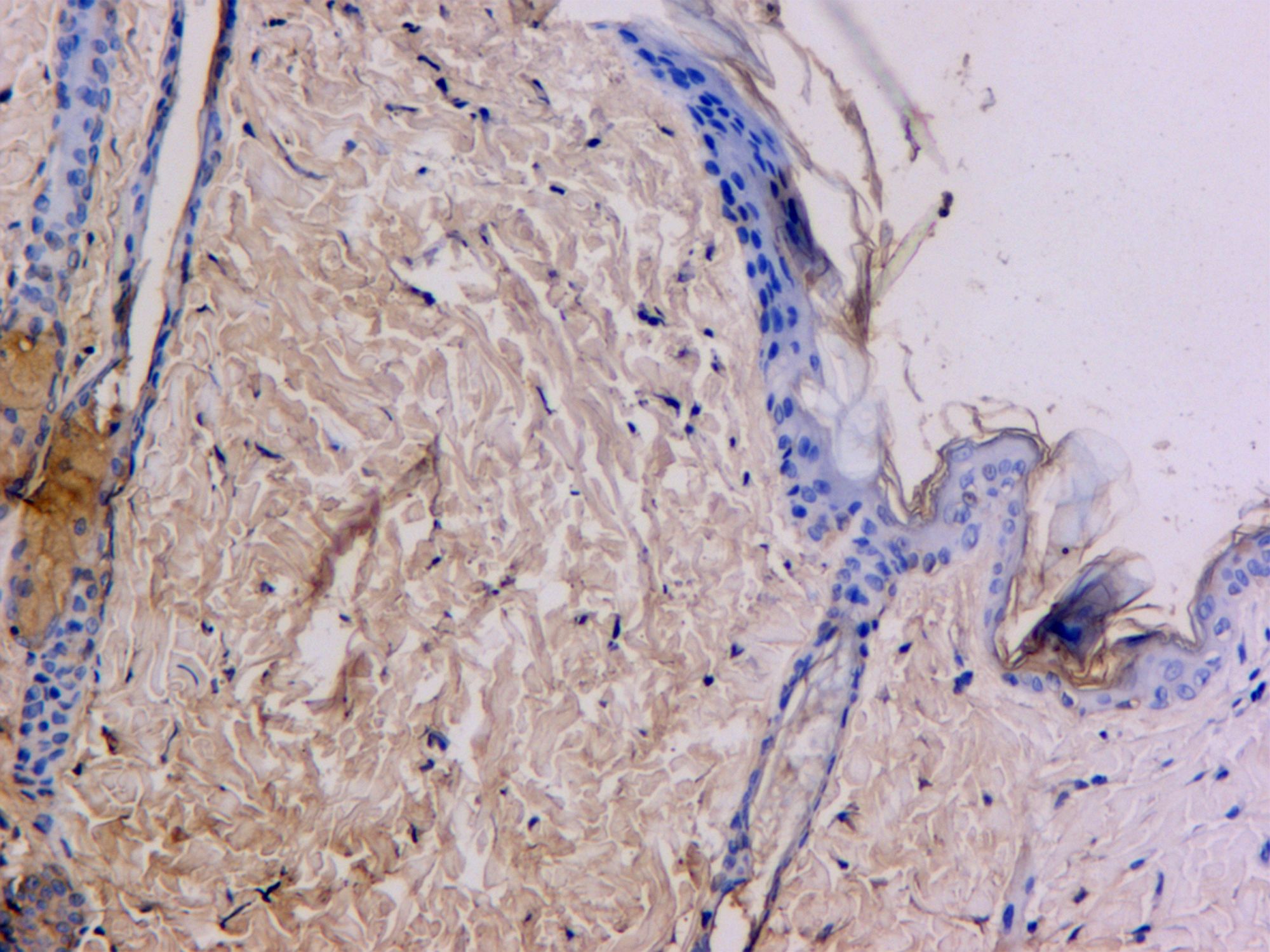 免疫組化-普拉特澤生物