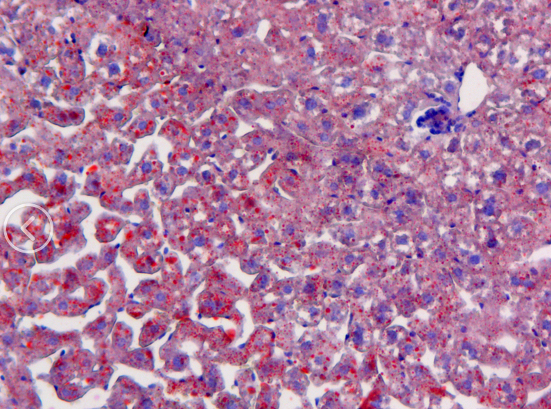 小鼠脂肪肝油紅O染色