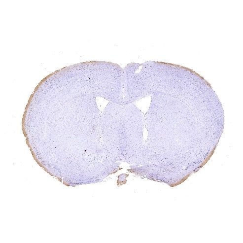 鼠腦普魯士藍染色