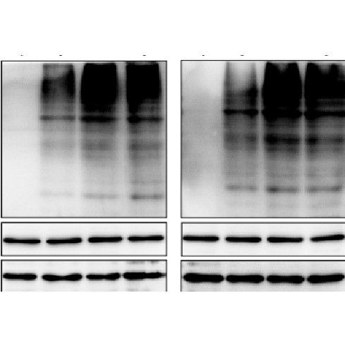 細(xì)胞CO-IP泛素化檢測(cè)