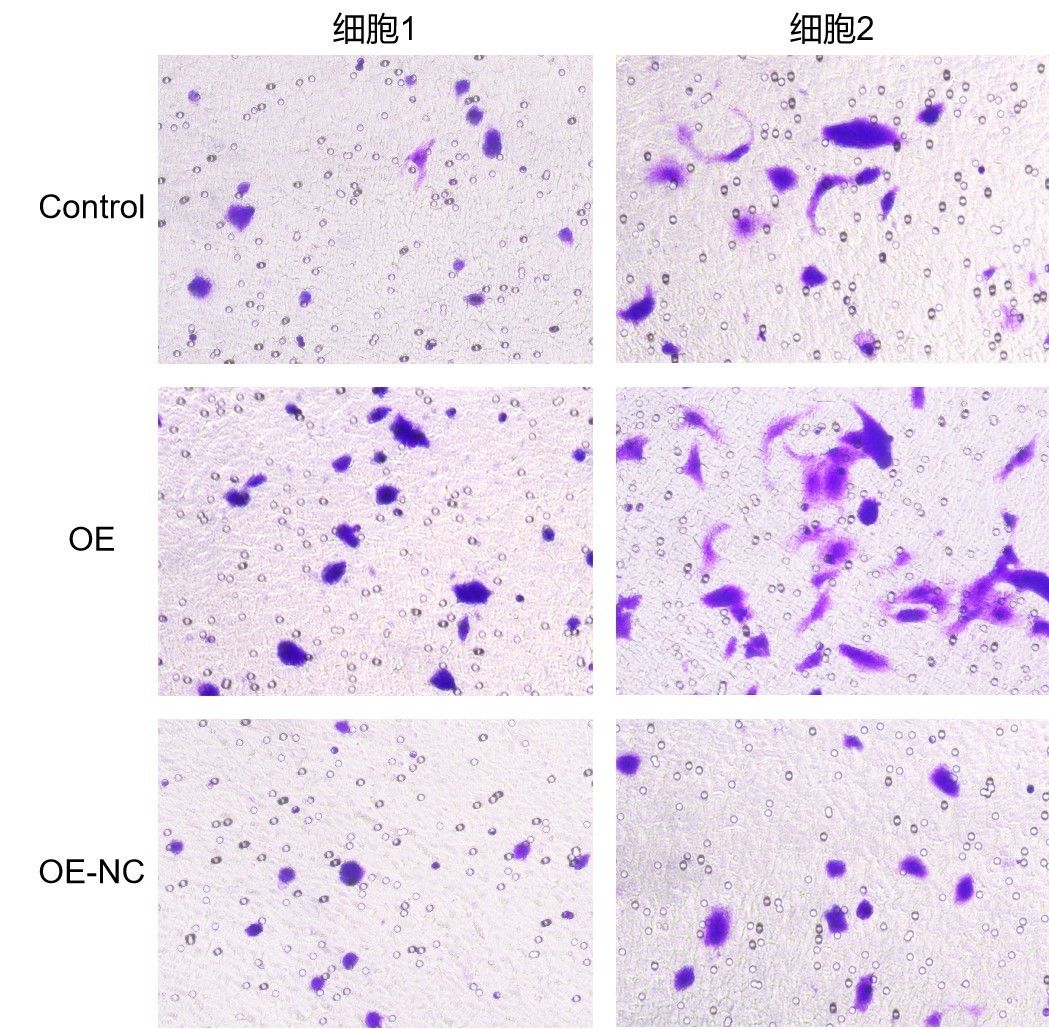 細(xì)胞侵襲實(shí)驗(yàn)