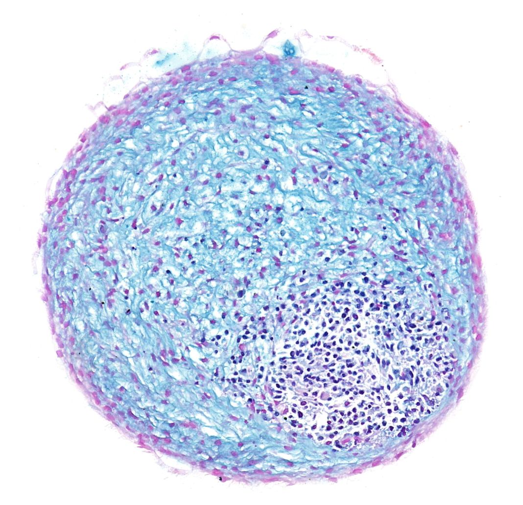 甲苯胺藍(lán)染色