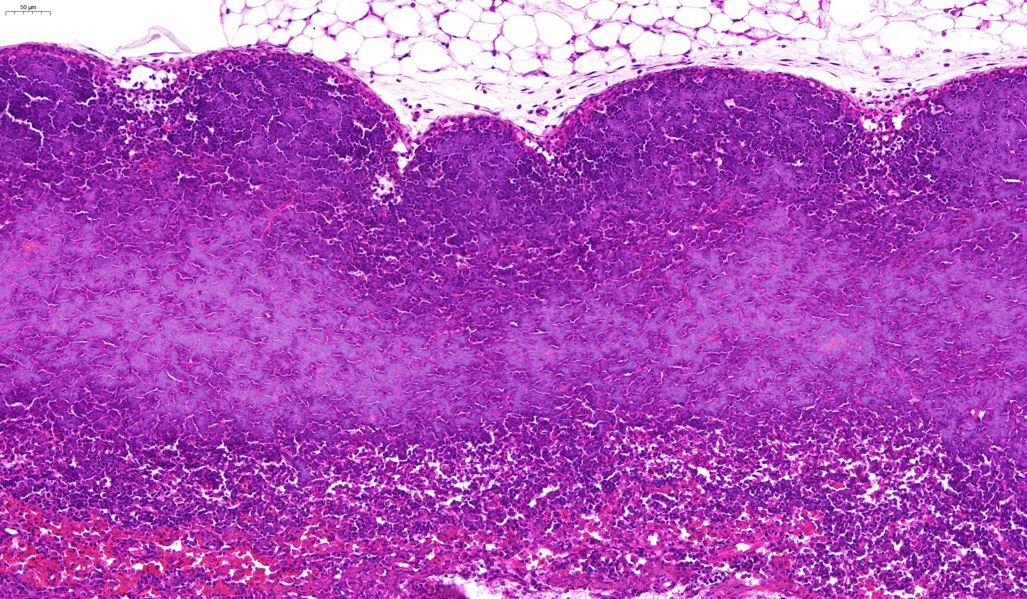 胰腺組織HE染色