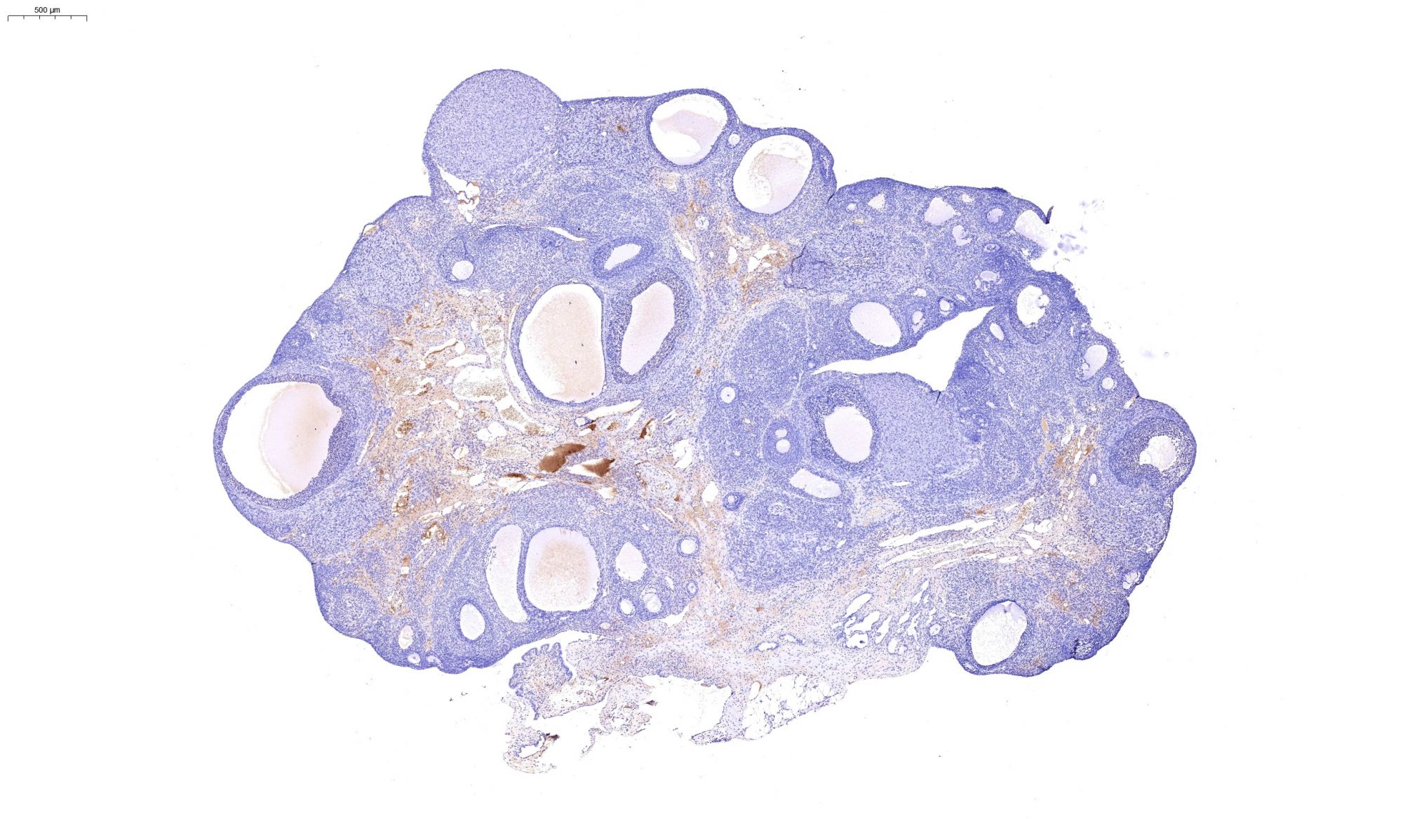 免疫組化染色-卵巢