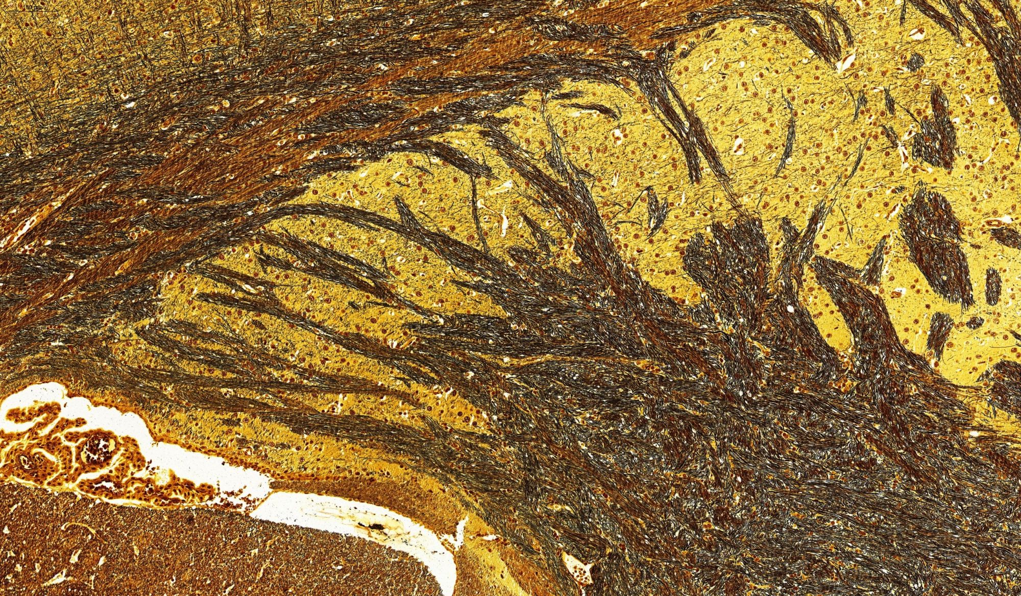 腦組織高爾基體染色