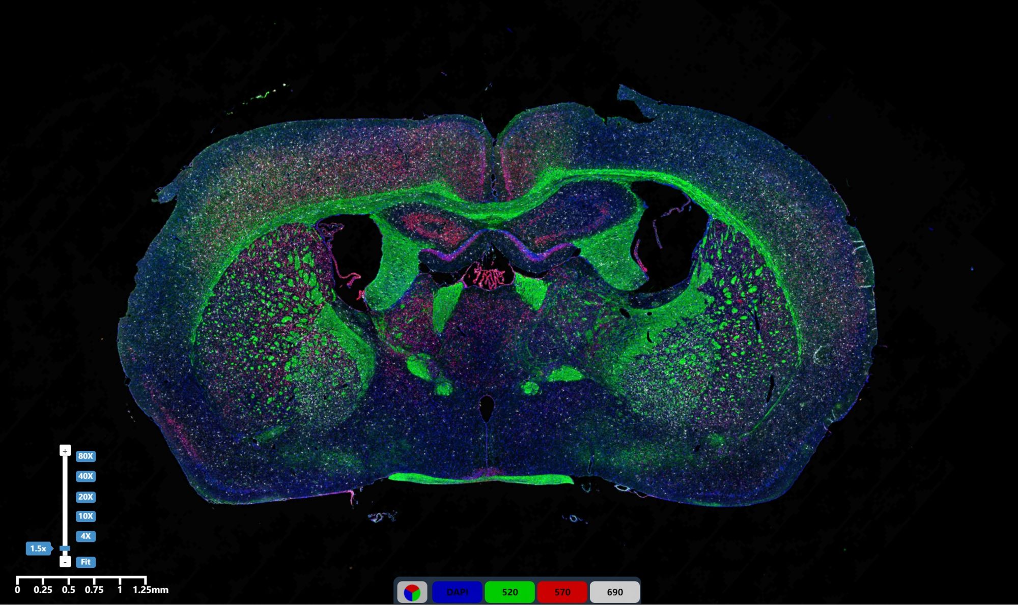免疫熒光三標(biāo)腦組織2