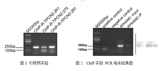 CHIP實(shí)驗(yàn)注意事項(xiàng)
