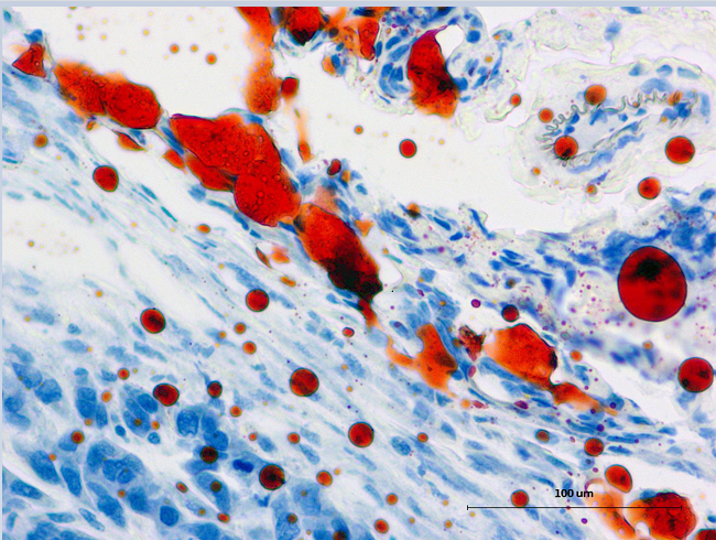 冰凍切片-普拉特澤