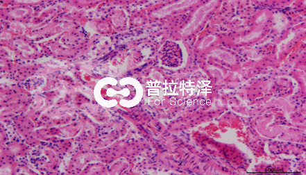 HE染色-普拉特澤