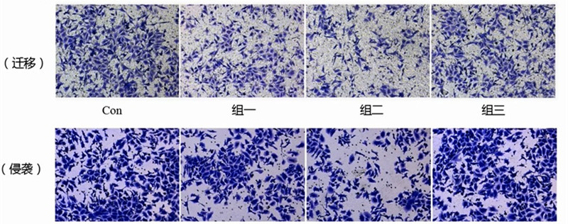 1619754307559558.jpg transwell333.jpg