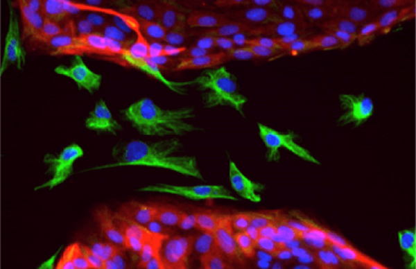 1619754750586402.png 89685.png