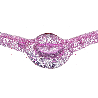 茶樹葉片番紅固綠染色